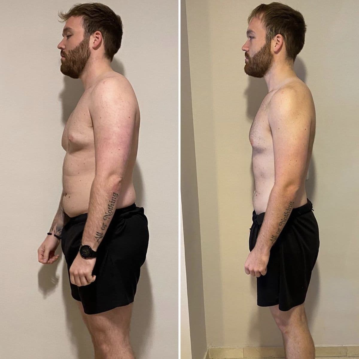 Before and After 6